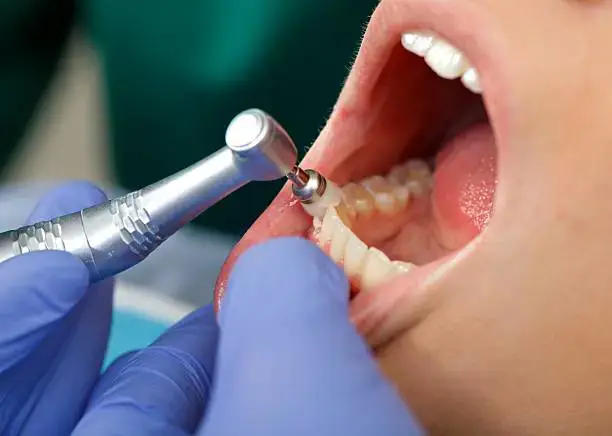 Dental Photo